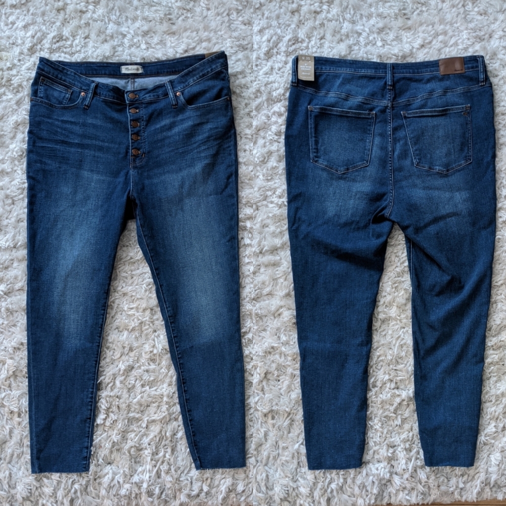 Madewell | Mid Rise Button Fly Skinny Jean